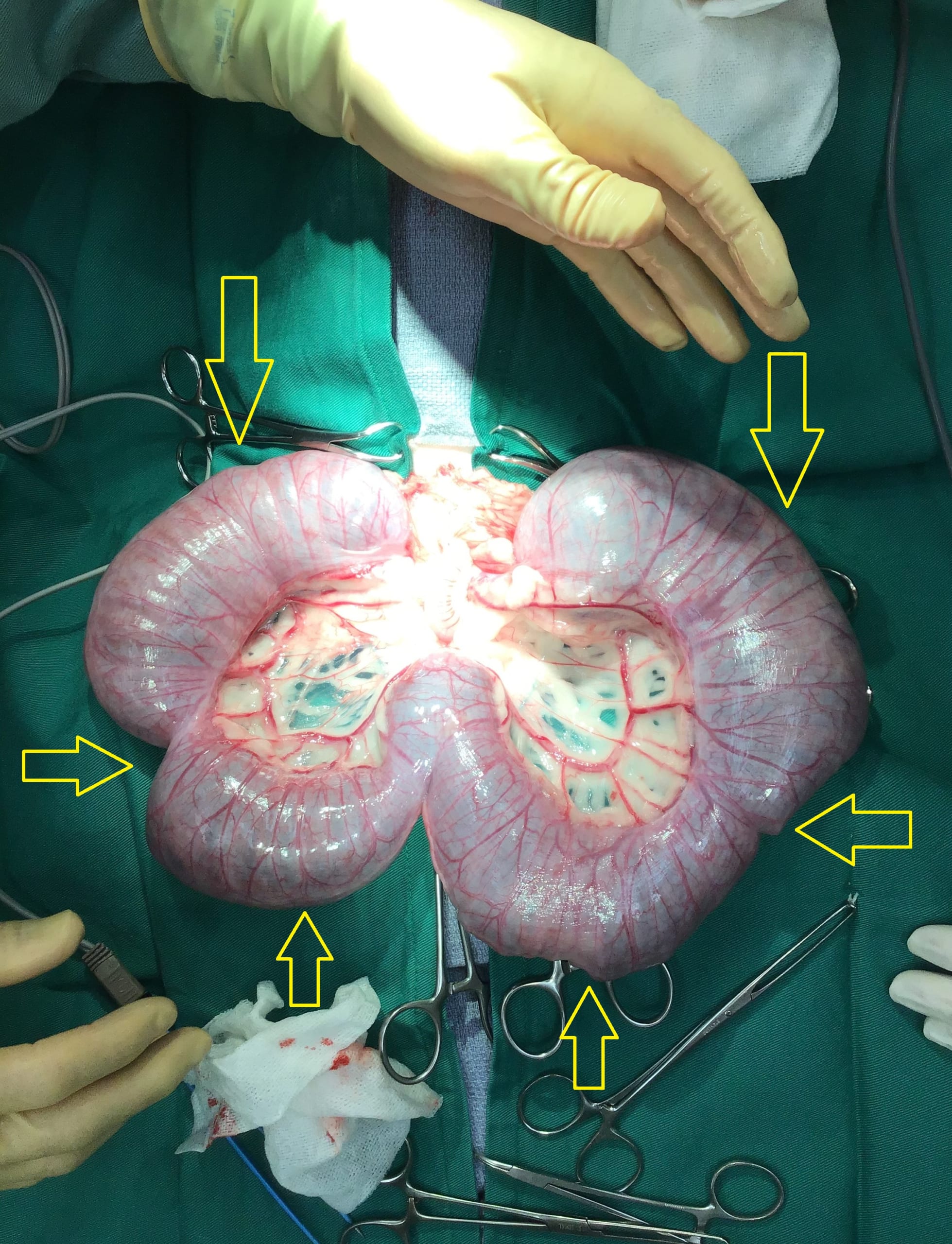25 犬の子宮蓄膿症 未避妊の多飲多尿には要注意 林動物病院